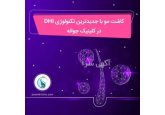 کاشت مو با جدیدترین تکنولوژی DHIدر کلینک جوانه کاشت مو با جدیدترین تکنولوژی DHIدر کلینک جوانه