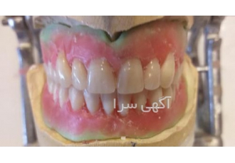 لابراتوار دندانسازی دندان ساز مصنوعی سیار در محل خانه