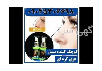 کرم کوچک کننده بسیار قوی ۲N در تهران بهترین کرم کوچک کننده جهان 2N ساخت