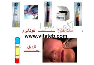 فروش سانتریفیوژ PRP - کیت PRP