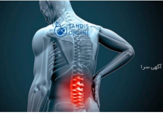 عمل دیسک کمر عمل دیسک کمر