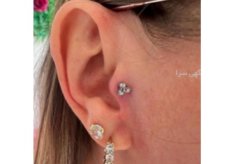 سوارخ کردن گوش بینی ابرو توسط پزشک سوارخ کردن گوش بینی ابرو توسط پزشک