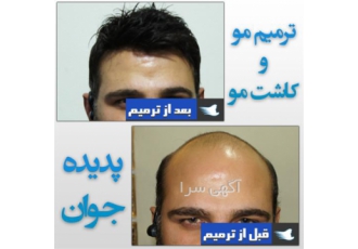 مشاوره رایگان (ترمیم مو پدیده جوان) مشاوره رایگان (ترمیم مو پدیده جوان)