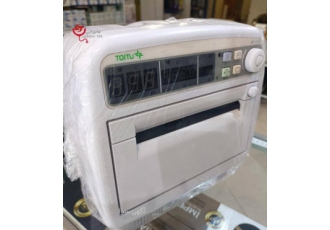 فتال مانیتورینگ NST تویتو نوار قلب جنین فتال مانیتورینگ NST تویتو نوار قلب جنین