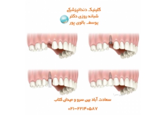 داشتن دندان های زیبا و سالم با دندانپزشکی بالوی پور