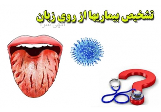 دوره آموزش مزاج شناسی و زبان شناسی و تغذیه سالم در تهران دوره آموزش