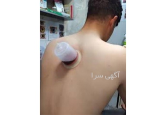 آموزش طب سنتی با مدرک معتبر در شهر های مختلف با تخفیف ویژه در شیراز