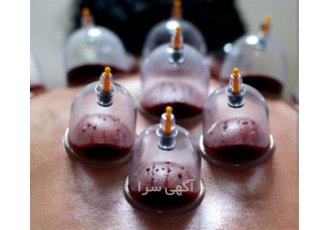 آموزش بادکش درمانی و پاکسازی پوست، آموزش بادکش آموزش بادکش درمانی و پاکسازی پوست، آموزش بادکش