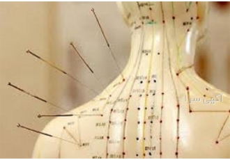 آموزش طب سوزنی به صورت اصولی آموزش طب سوزنی به صورت اصولی