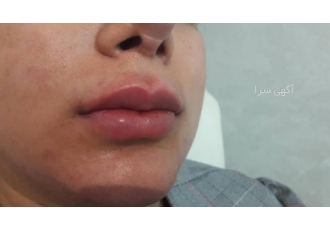 بهترین مرکز لیزر موهای زائد در تهران که با دستگاه های بهترین مرکز لیزر موهای زائد در تهران که با دستگاه های